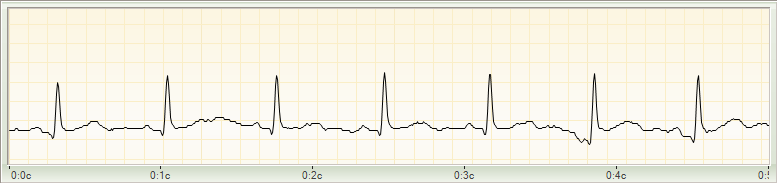 Cardio-Scan