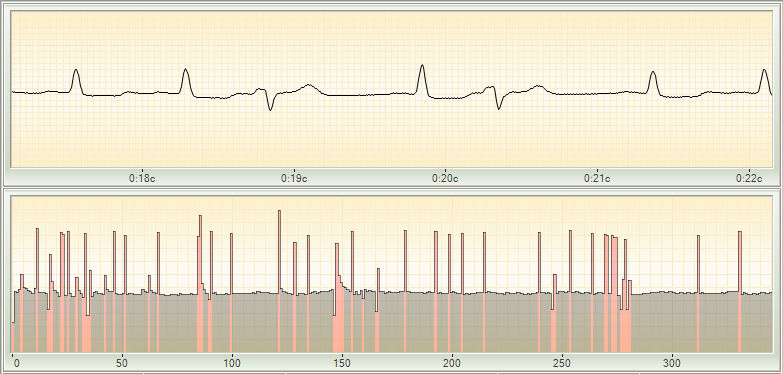 Cardio-Scan