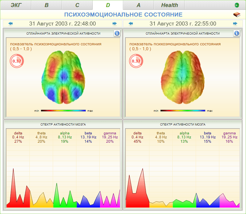 Cardio-Scan