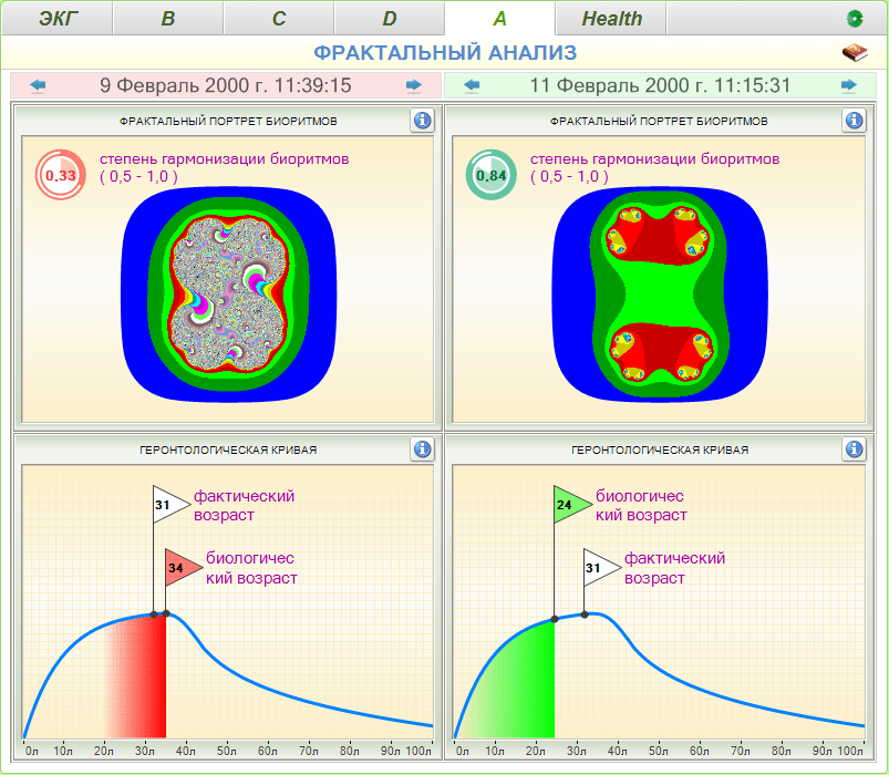 Cardio-Scan